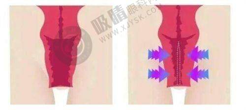 深圳非凡医疗美容医院怎么样：医院价格参考