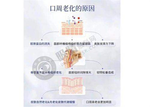 乐山人民医院激光科祛斑实例