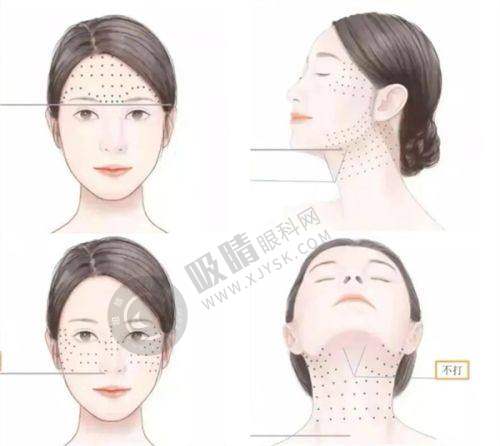 深圳鹏程整形医院怎么样？27年品牌老院，假体隆鼻+畸形鼻矫正技术获赞