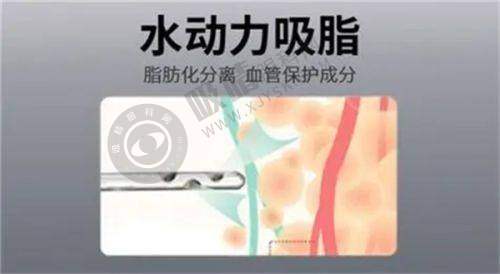 广州韩妃整形医院怎么样？李光琴医生