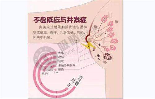 成都素美医疗美容门诊怎么样：医院价格参考