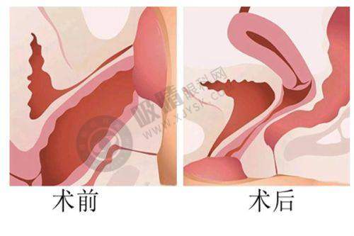上海眼修复医生杜园园医生价格相关说明