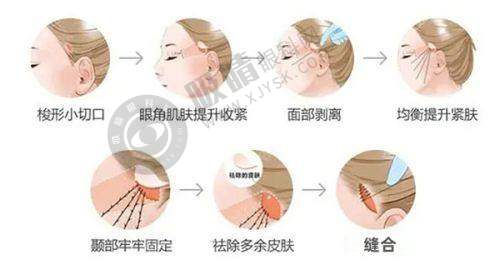 淄博天丽整形美容医院怎么样？专业疤痕修复+私密紧缩针技术获赞，5年口碑医院