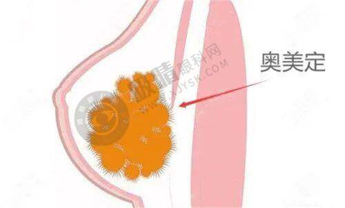 四川绵阳茗汇悦美整形怎么样？王亮院长亲诊眼综合手术，真人案例效果惊艳