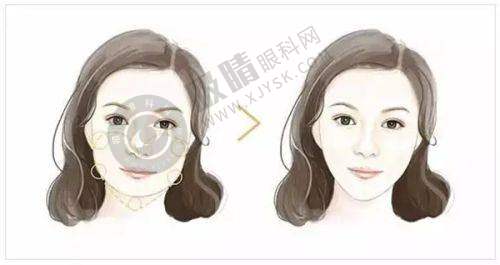 东莞爱思特（原华美）医疗美容口腔门诊怎么样——医院地址与挂号指南