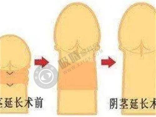 成都中医大银海整形怎么样？眼整形修复技术领先，术后肿胀明显缩短。顾客口碑99%