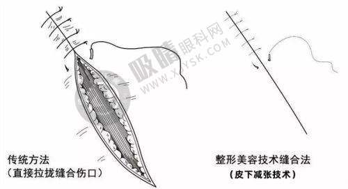 2025长沙无痕筋膜提升好的医院排名之长沙美莱医疗美容医院
