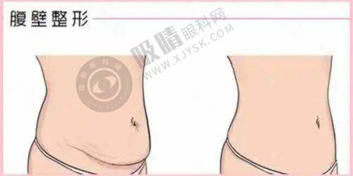 广州丽合医疗美容医院怎么样：医院价格参考