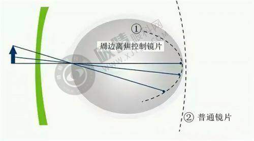 [深圳新视代眼科医院]患者评价