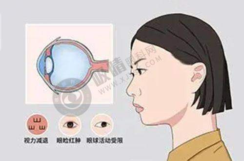 [赣州普瑞眼科医院]预约挂号方式及流程