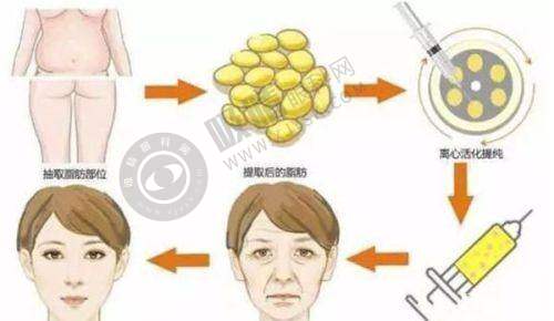 长沙雅美医疗美容医院怎么样——医院价格参考