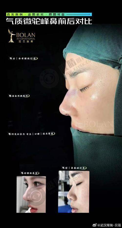 赣州华美医疗美容门诊部怎么样——医院医生风采