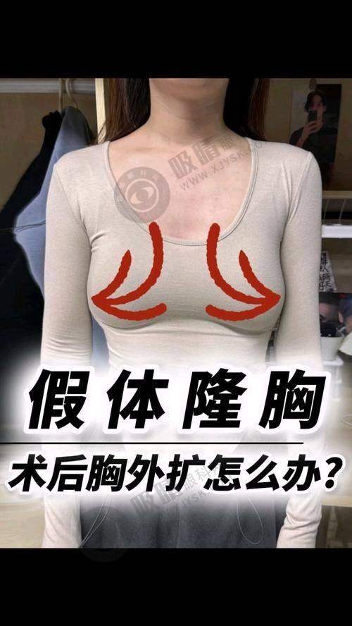 赣州华美医疗美容门诊部怎么样？方贤成医生微创隆胸技术精湛，术后效果自然手感真实