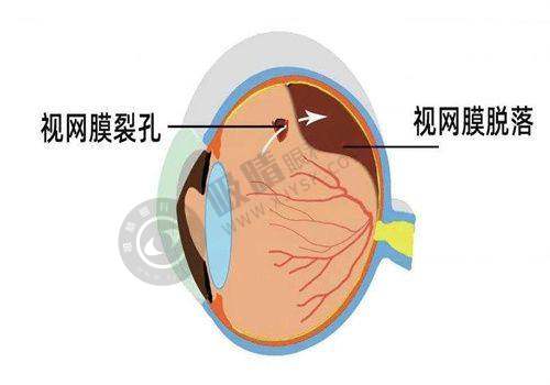 二、永州眼科医院有哪些特色科室？