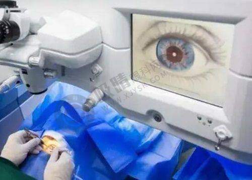 福州普瑞眼科门诊口碑怎么样？林青鸿医生技术获赞，全飞秒手术15000元起