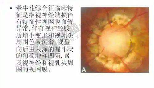 四、长沙蓝猫眼科门诊部患者评价怎样？
