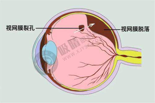 五、山东爱维视眼科诊所与山东爱维视眼科医院有什么关联和区别？