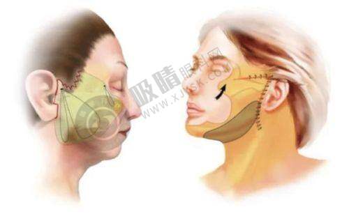 [襄阳童颜伊美整形]简介概述