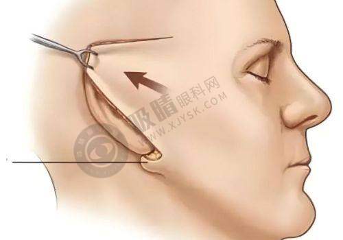[荆州熙蒙医疗美容门诊部]患者评价