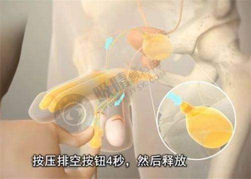 [武汉光泽皇后整形]特色项目及技术优势