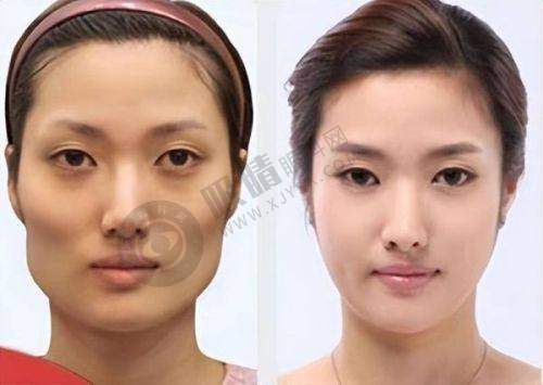 湖北十堰绽颜整形：有哪些热门医美项目？