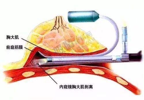 选择襄阳韩蔻整形医院的理由