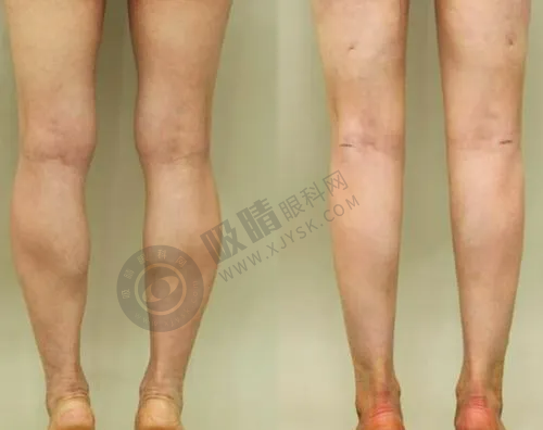 [武汉恒美医疗美容门诊部（江汉店）]患者评价