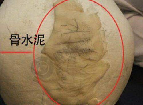 武汉伽美医疗美容医院：预约挂号方式及流程