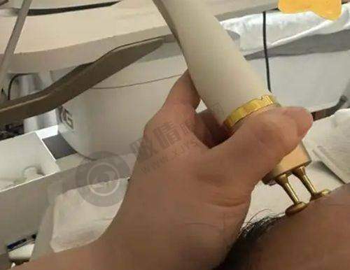 荆州青逸美植发的技术优势在哪?