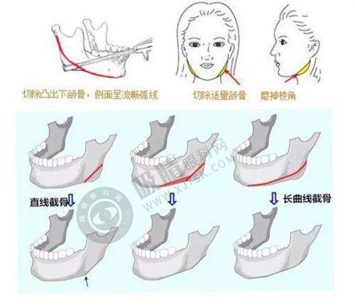 宜昌伊莱美整形医院的技术优势