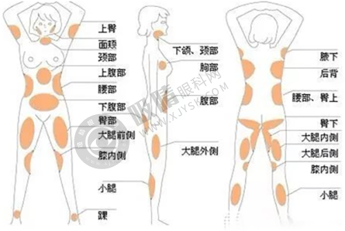 国内变性手术免费预约:收费情况