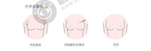 湖北武汉仁爱医院植发科：真实可靠的植发实例