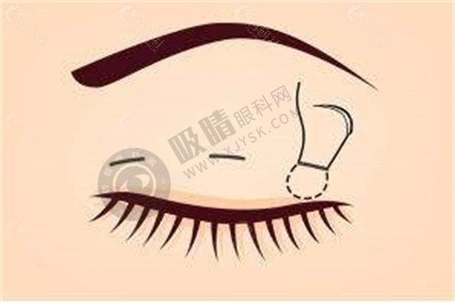 武汉恒美医疗美容门诊部（汉阳店）的热门医美项目有哪些？