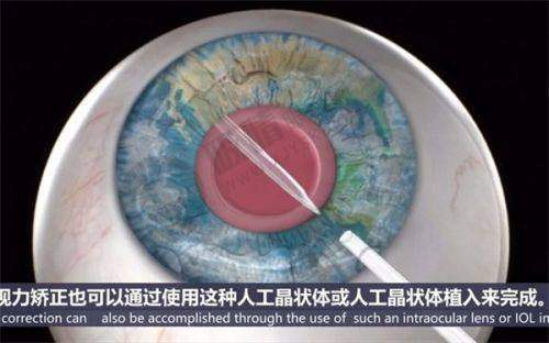 黑龙江长庚医疗眼科医院：简介概述