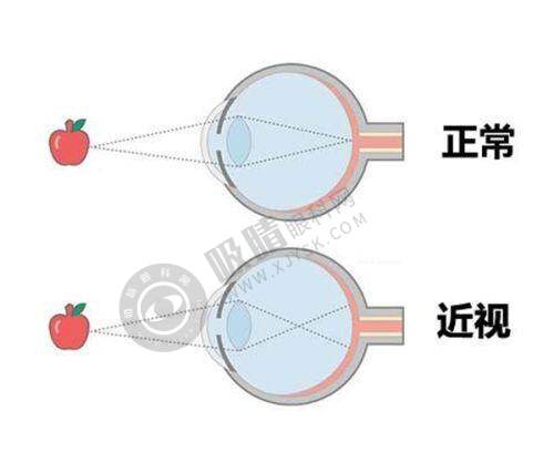 深圳瞳悦明恒裕眼科诊所来院路线