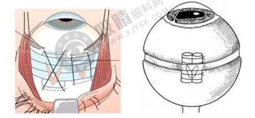 长沙明朗眼科