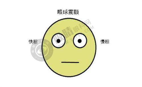 毕节威宁视康眼科医院来院路线