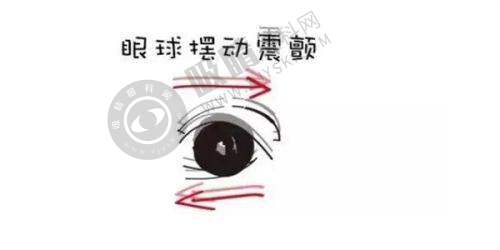 2025杭州白内障手术免费政策申请流程