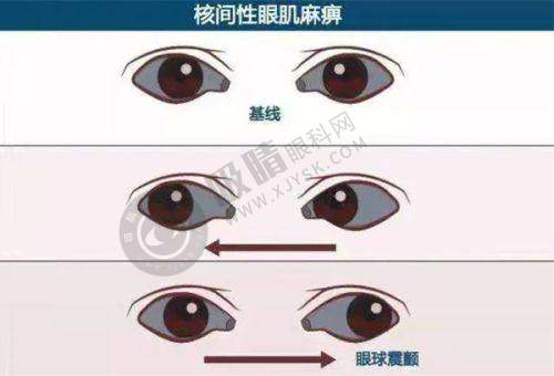 总结