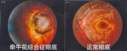 [佛山市雅科眼科诊所有限公司三水医视诊所]合理价格