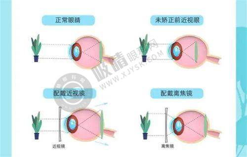 阜阳泽明眼视光眼科医院