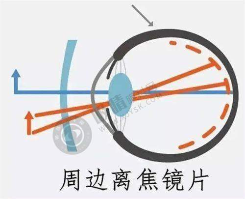 泉州惠明欧普眼科诊所
