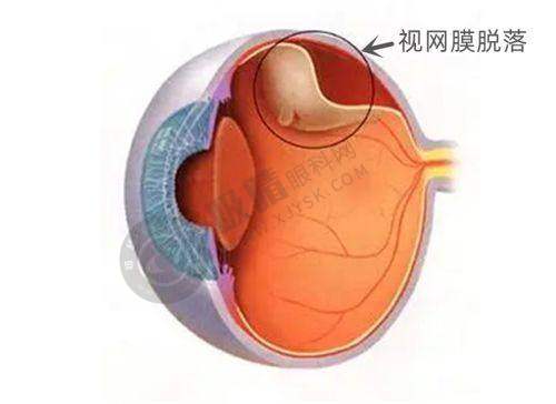 [泉州惠明欧普眼科诊所]简介概述