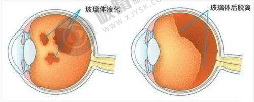 黑龙江长庚医疗眼科医院
