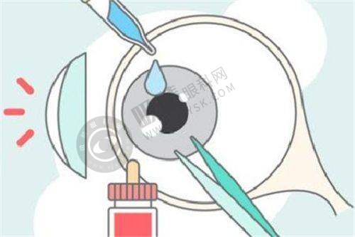 二、深圳瞳悦明恒裕眼科诊所儿童近视防控有哪些优势?