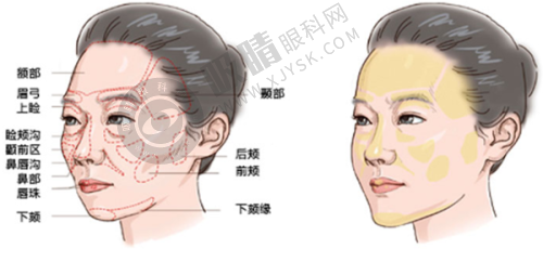 孝感黄清雨时光整形怎么样？眼综合3980元起，显微技术打造自然电眼，口碑爆棚