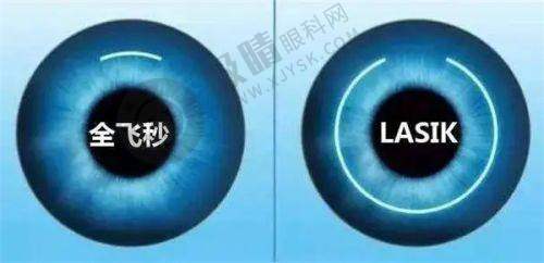 [韩国明目眼科]特色项目及技术优势