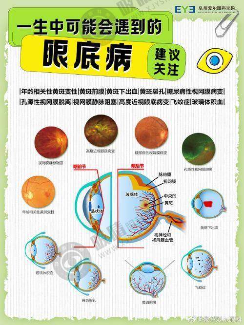 [深圳深北爱尔眼科医院]结尾