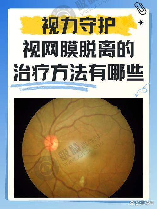 广州康晶眼科门诊部