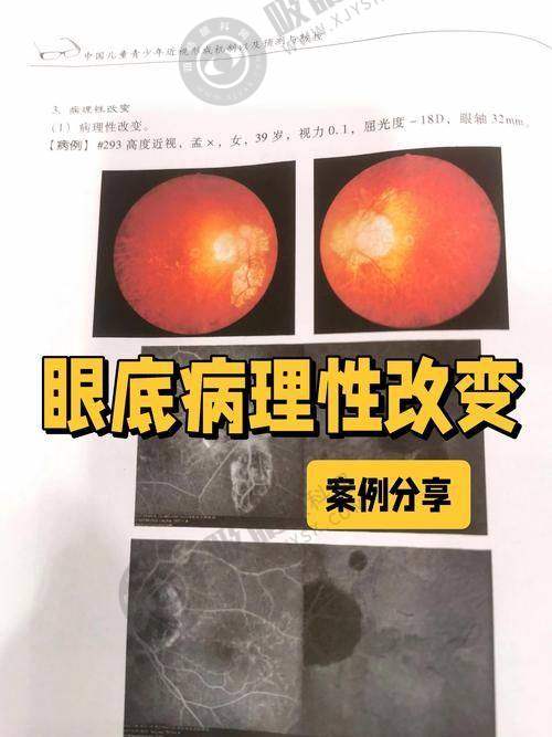 [广州康晶眼科门诊部]患者评价